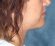 necklift-01-after-c-flint