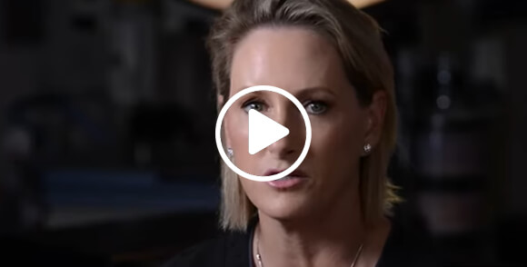 Patti Flint - Filler + BOTOX