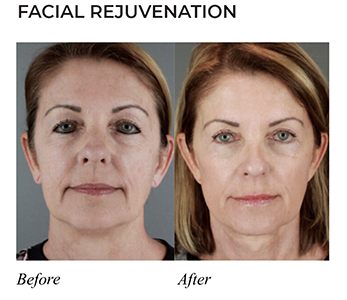 Before-and-Afters_02