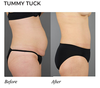 Before-and-Afters_06
