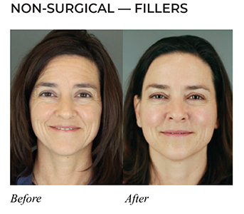 Before-and-Afters_08