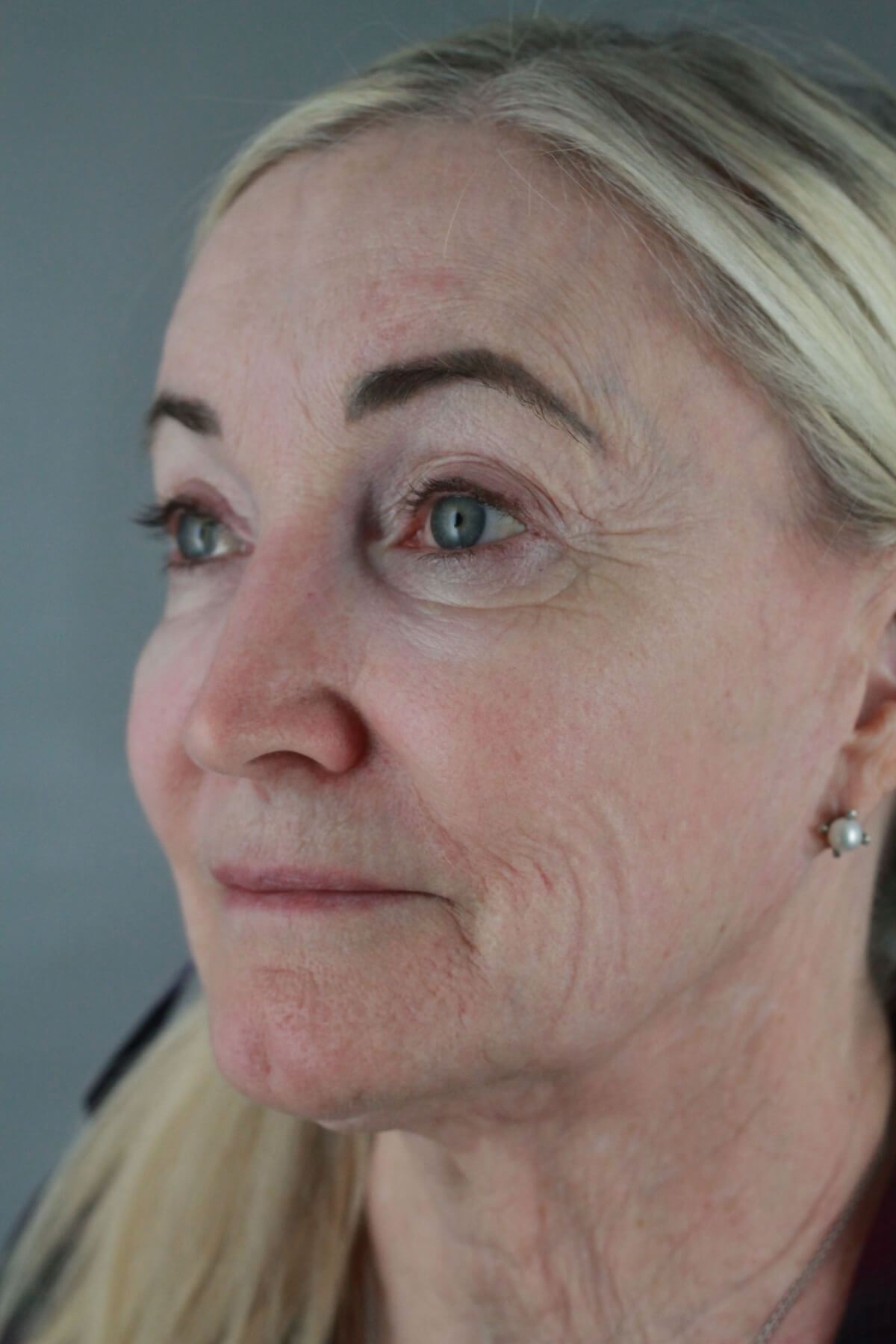 Case--2012 | Before Volbella 2