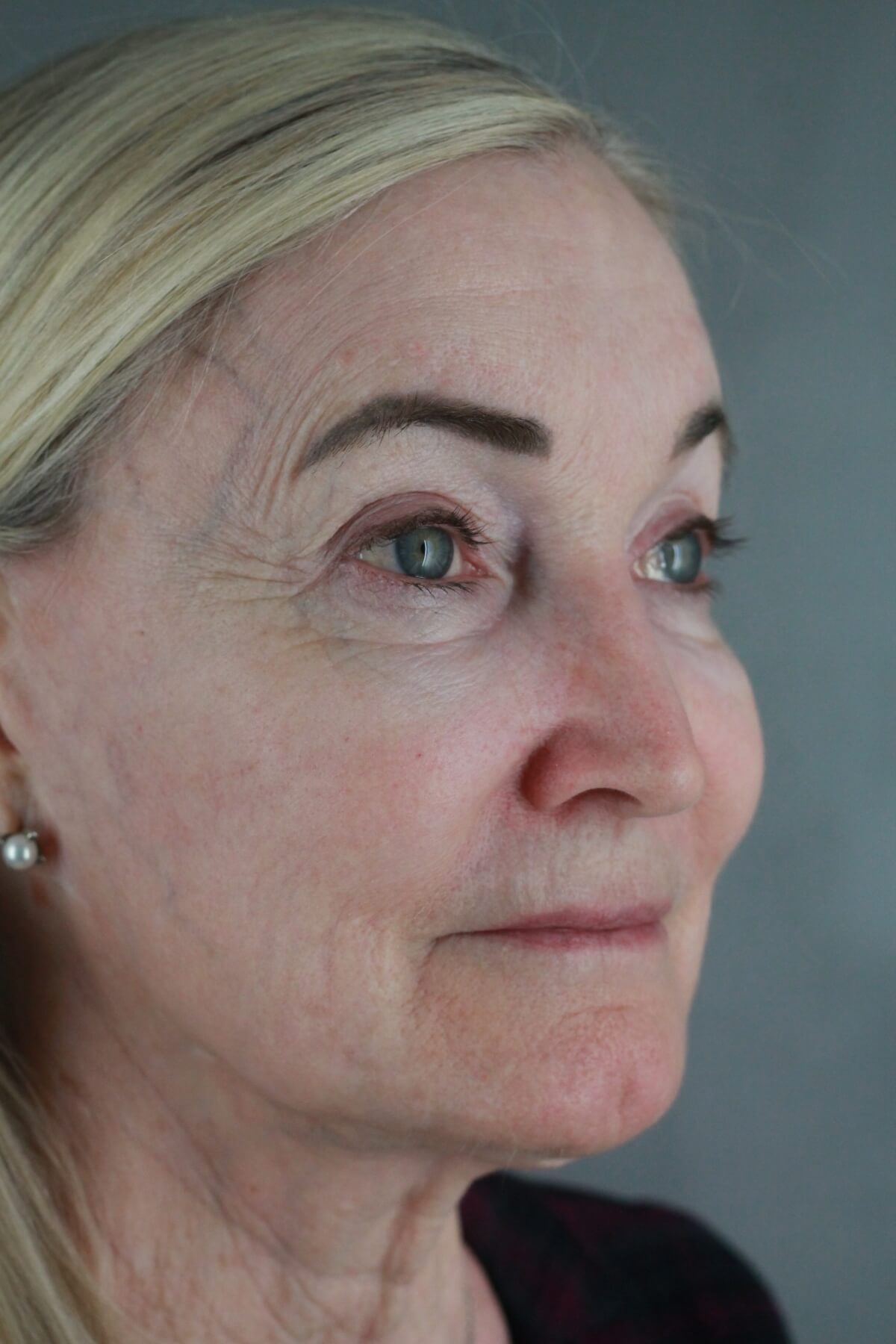 Case--2012 | Before Volbella 3