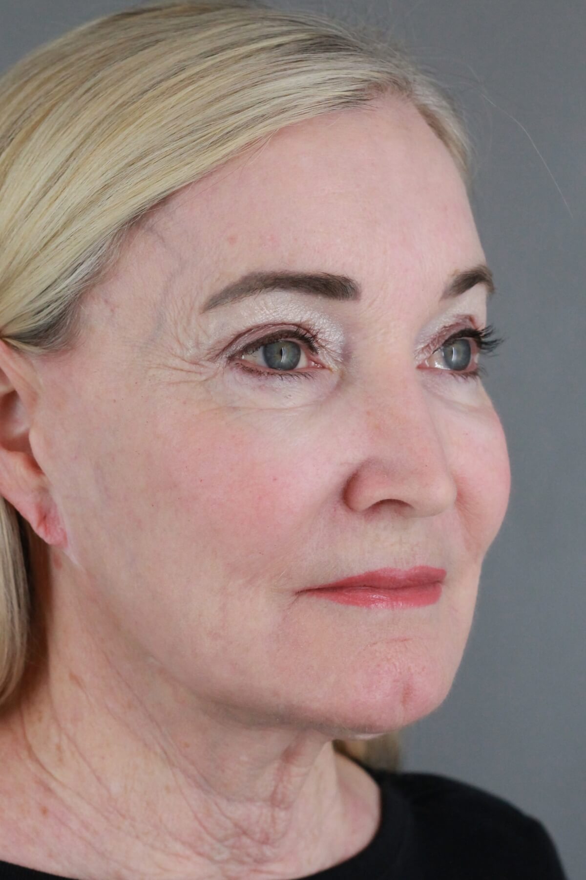 Case--2012 | After Volbella 3